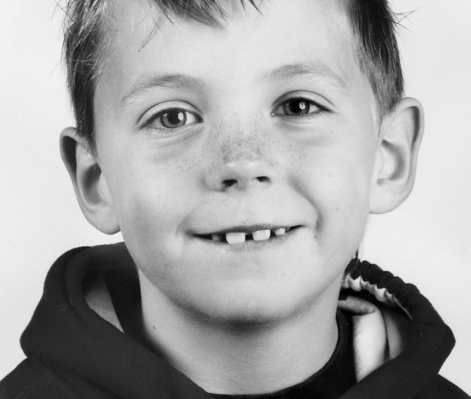 Billedet viser Alexander som 8 årig med mellemrum mellem tænderne.