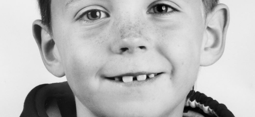 Billedet viser Alexander som 8 årig med mellemrum mellem tænderne.