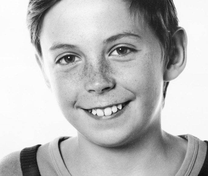 Billedet viser Alexander som 13 årig med næsten ingen mellemrum mellem tænderne.