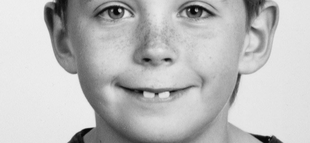 Billedet viser Alexander som 9 årig med mindre mellemrum mellem tænderne.