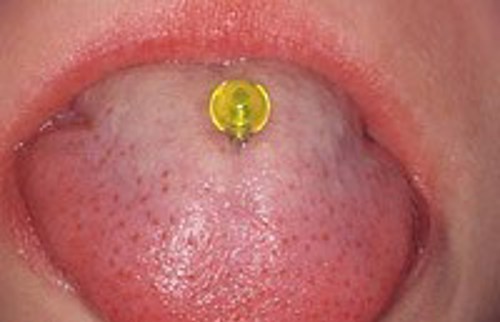 Billedet viser en tungepiercing.
